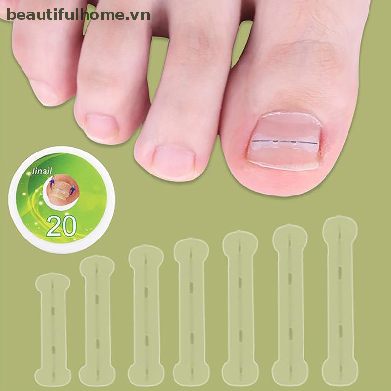 Set 10 Kẹp Cố Định Móng Chân Tiện Dụng Chất Lượng Cao