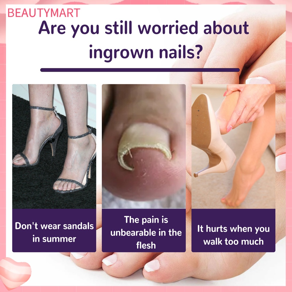 Set 50 Miếng Dán Móng Chân Tự Dính Chống Nước Thoáng Khí Chỉnh Sửa Lỗ Chân