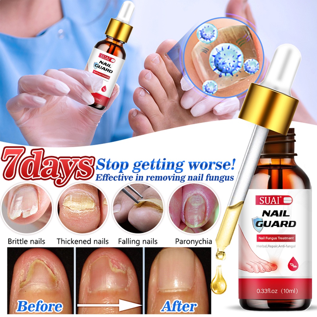 10ml Móng Tay Điều Hỗ trợ giảm nấm Serum Chống Nhiễm Trùng Paronychia Onychomycosis Loại Bỏ Ngón Chân Nấm Bàn Tay Sửa Chữa Gel Chăm Sóc Serum