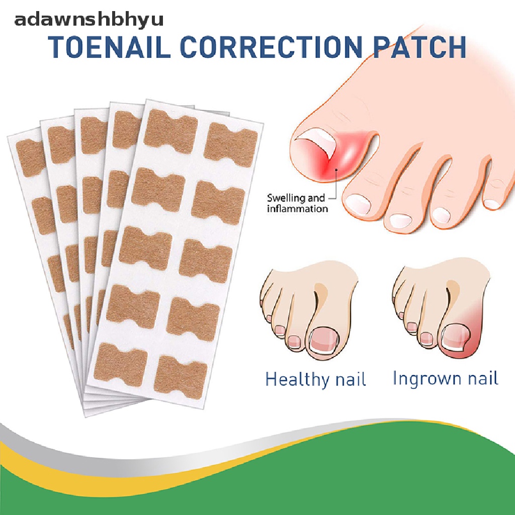 Set 50 Miếng Dán Chỉnh Sửa Móng Chân Tiện Dụng