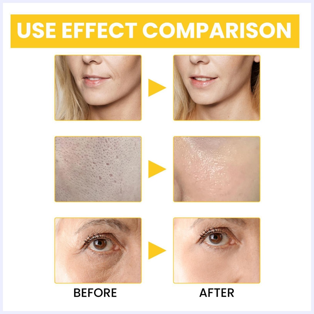 EELHOE Retinol Anti-Wrinkle Essence Làm căng da mặt, mờ nếp nhăn rãnh mũi má, dưỡng da chống lão hóa