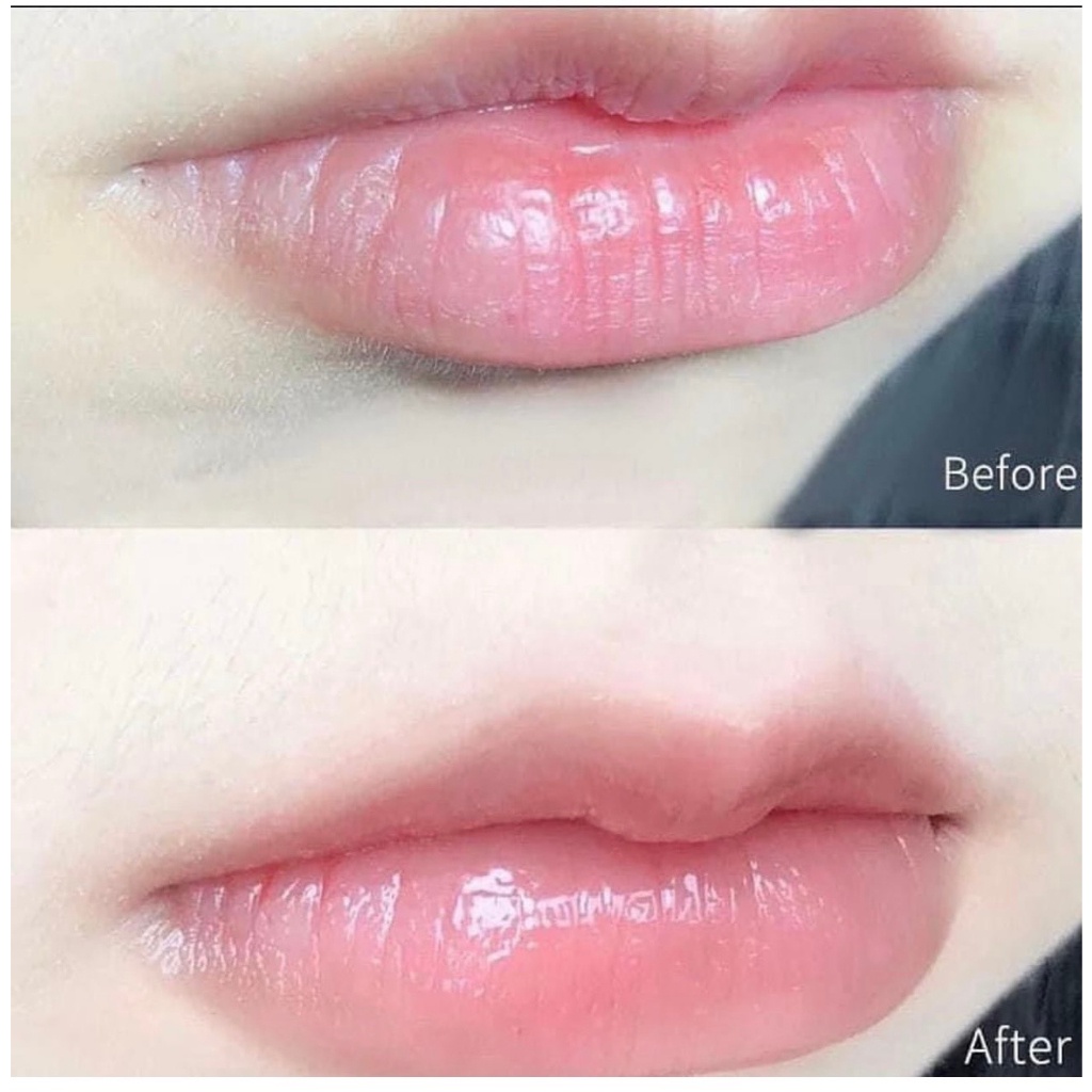 Sáp Son Dưỡng Môi Vaseline Mang Lại Làn Môi Mềm Mọng Ngay Lần Đầu Sử Dụng 7g