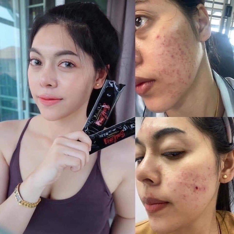 Bột Collagen trắng da giảm thâm mụn Saikono Collagen Tripeptide Aorraa Plus Thái Lan