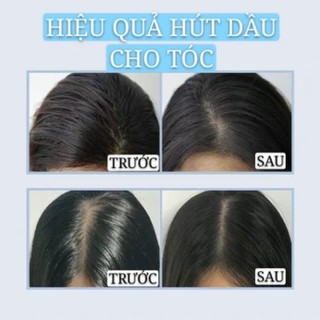 Dầu Gội Đầu Khô ISSY