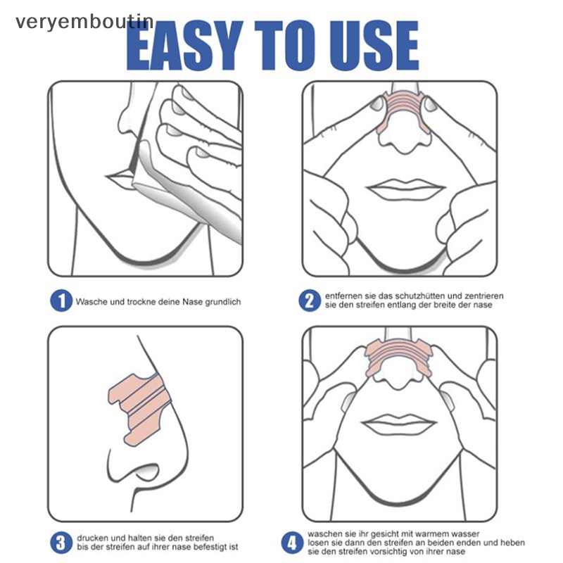 Set 10 Dải Mũi Chống Ngáy Ngủ Tiện Dụng