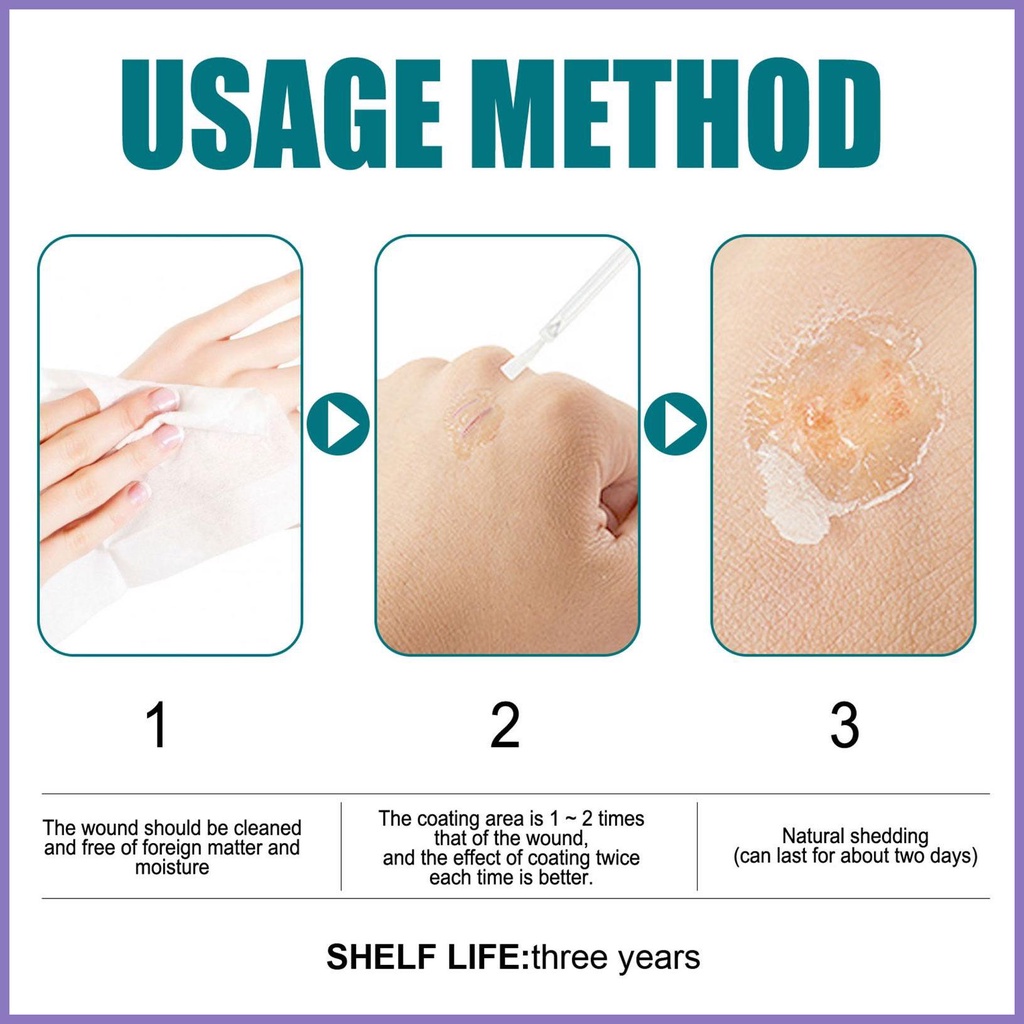 Băng Bó Vết Thương 10ml Dạng Lỏng Nhanh Khô Chống Thấm Nước Cho Minor Cuts nota2vn