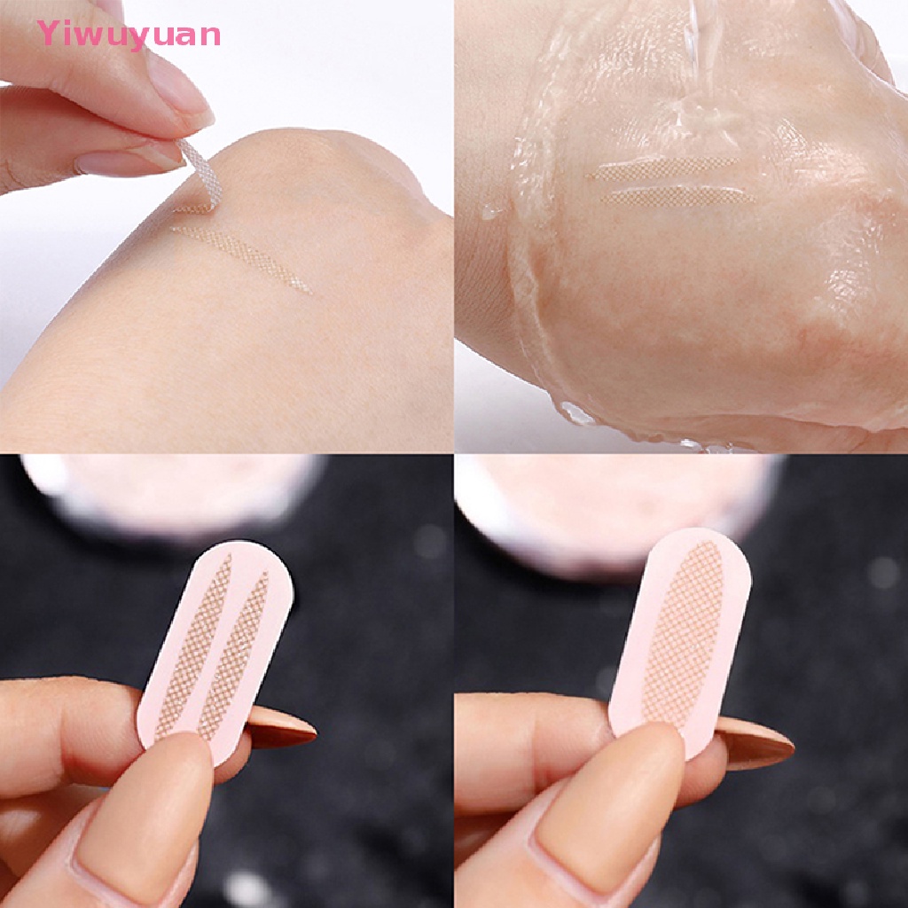 < Yiwuyuan > Miếng Dán Kích Mí Lưới Thoáng Khí Không Để Lại Dấu Vết
