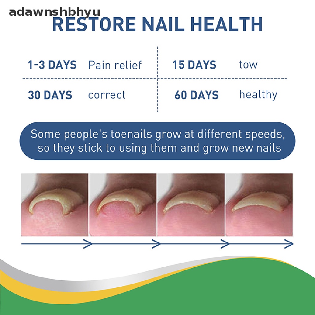 Set 50 Miếng Dán Chỉnh Sửa Móng Chân Tiện Dụng