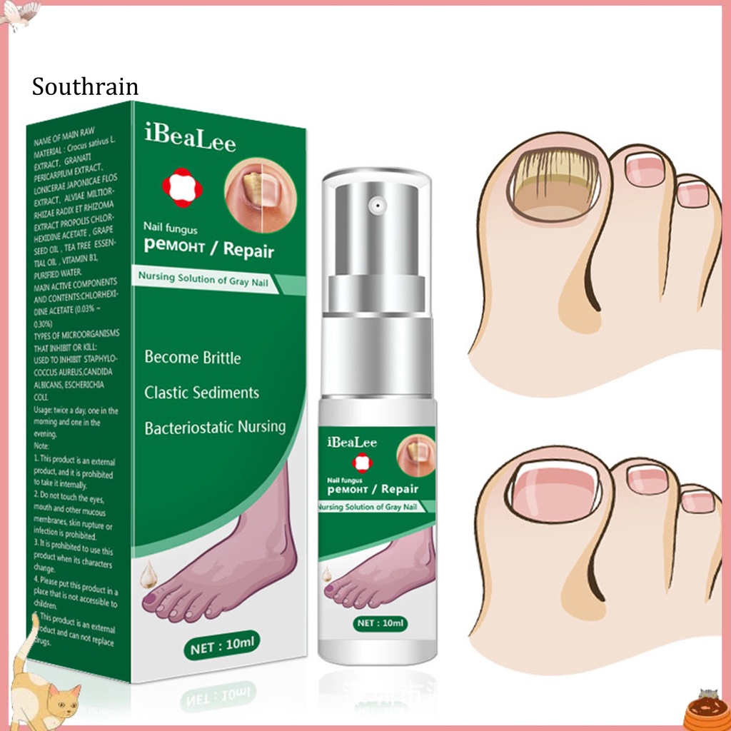 Dung Dịch Kháng Khuẩn 10ml Dễ Sử Dụng Cho Chăm Sóc Móng Tại Nhà