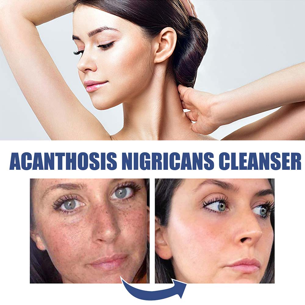 50ml Cleansing Lotion Moisturizing Relieving Dry Skin Facial Exfoliation Lighten Dark Pigmentation Facial Cleanser