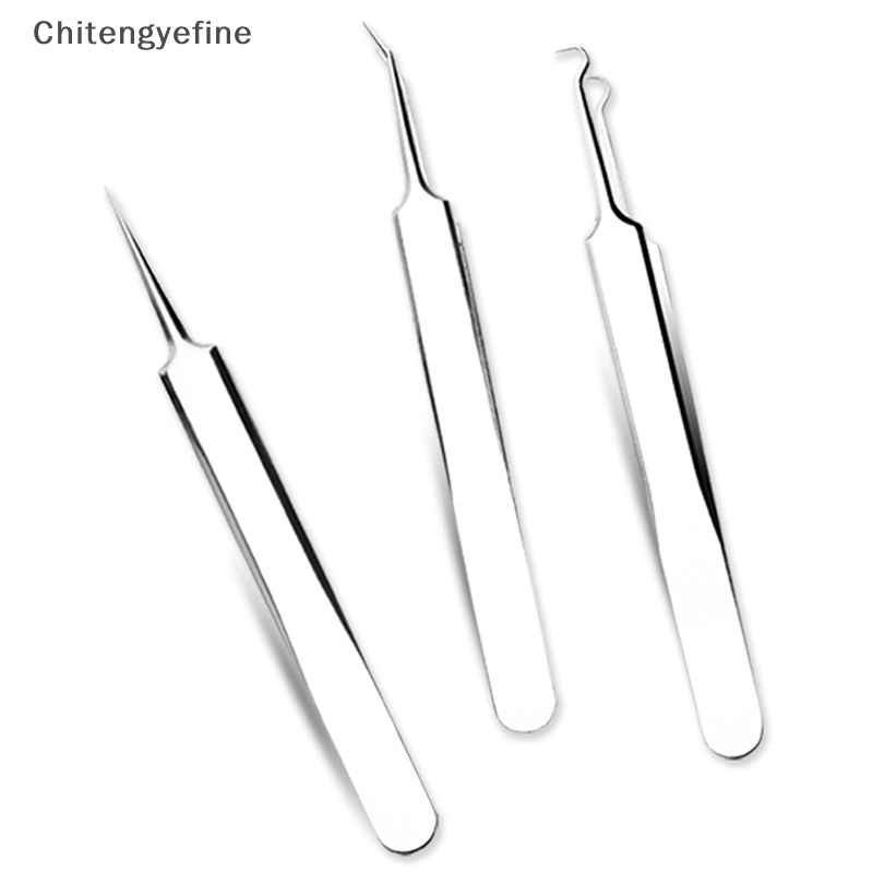 Nhíp Lấy Nhân Mụn Đầu Đen Chăm Sóc Da Mặt Mịn Màng