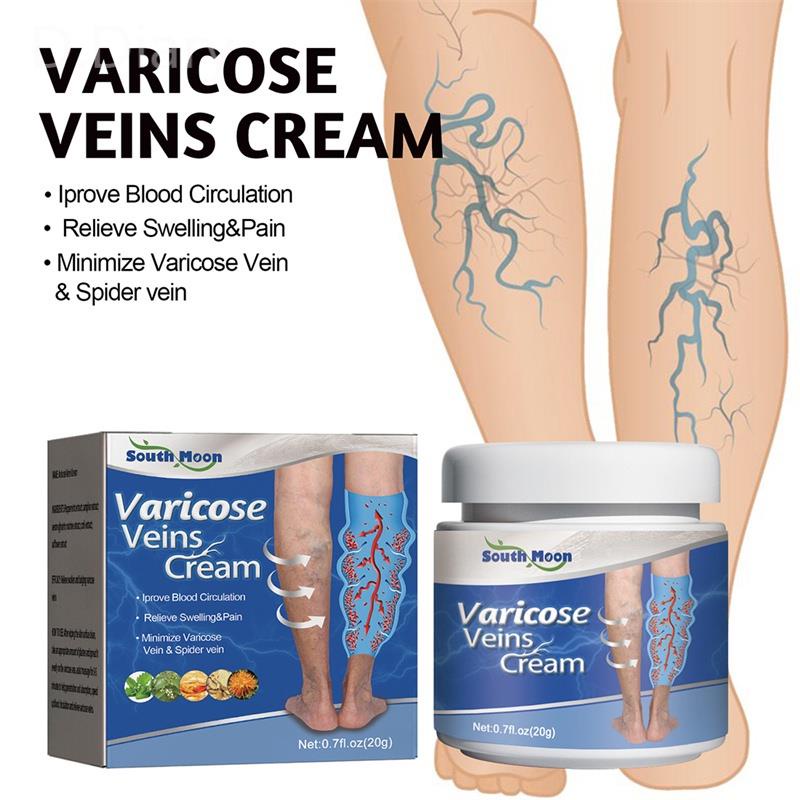 Kem Trị Giãn Tĩnh Mạch Giảm Đau Chân Hiệu Quả