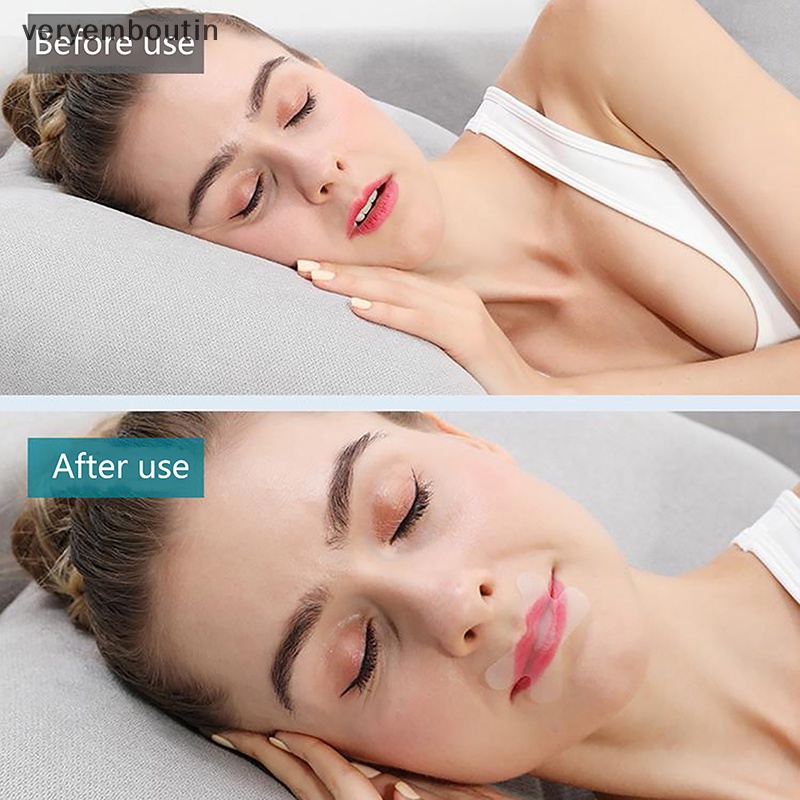 Set 30 / 36 Miếng Dán Mũi Chống Ngáy Khi Ngủ Sử Dụng Một Lần Tiện Lợi