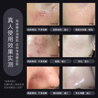 Bán Chạy#仁和洗面奶匠心植物氨基酸洁面乳深层清洁控油祛痘男女士专用8cc