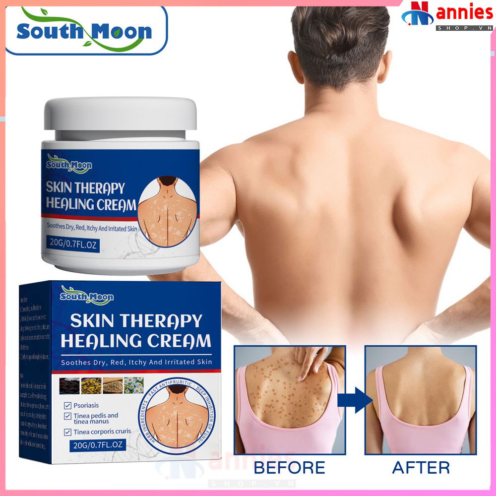 South Moon Kem Chống Đối Với Da Sửa Da Rêu Da Để Giảm Đau Kem Chăm Sóc Bên Ngoài 20g (annies.shop_vn)