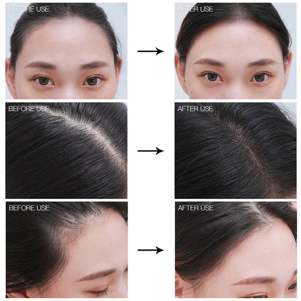 Phấn Che Khuyết Điểm Đường Chân Tóc SUAKE N6J5