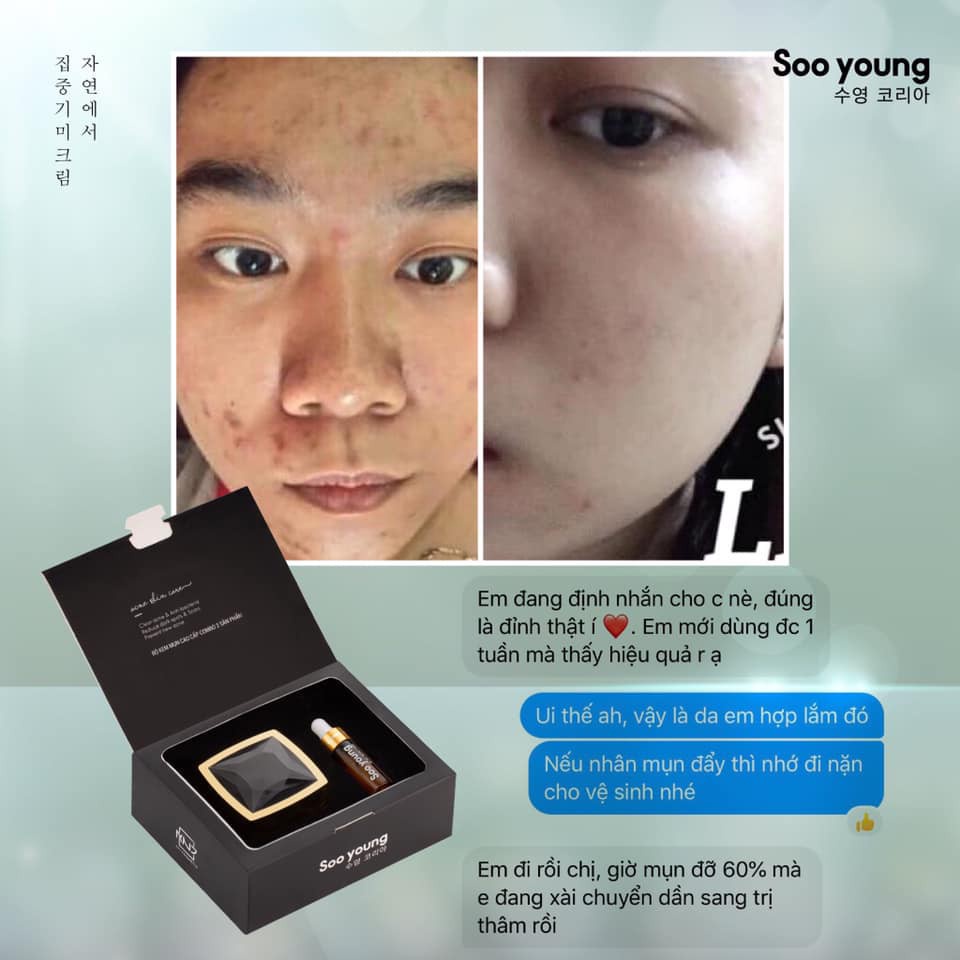 Kem face mụn Soo Young tặng kèm serum mụn Lục Tảo Soo young
