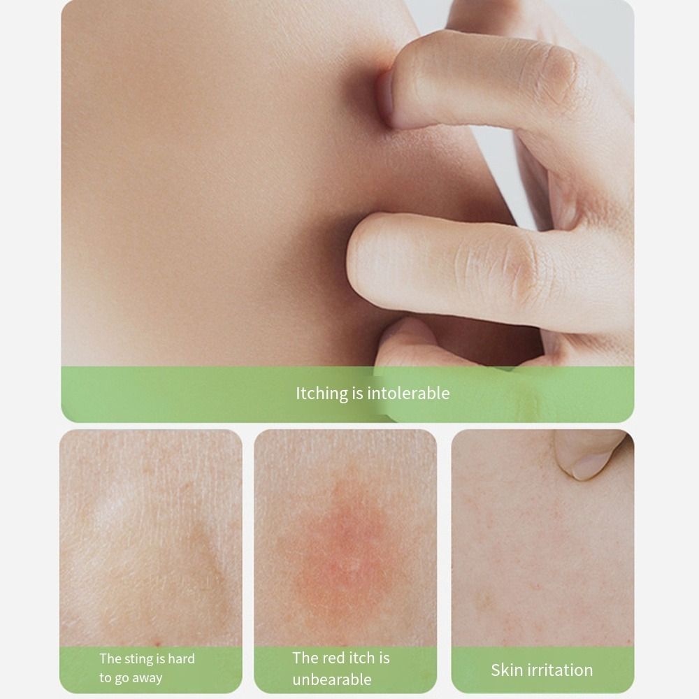 Que Chống Muỗi VANES1 Lâu Trôi Chống Sưng Da Tiện Dụng