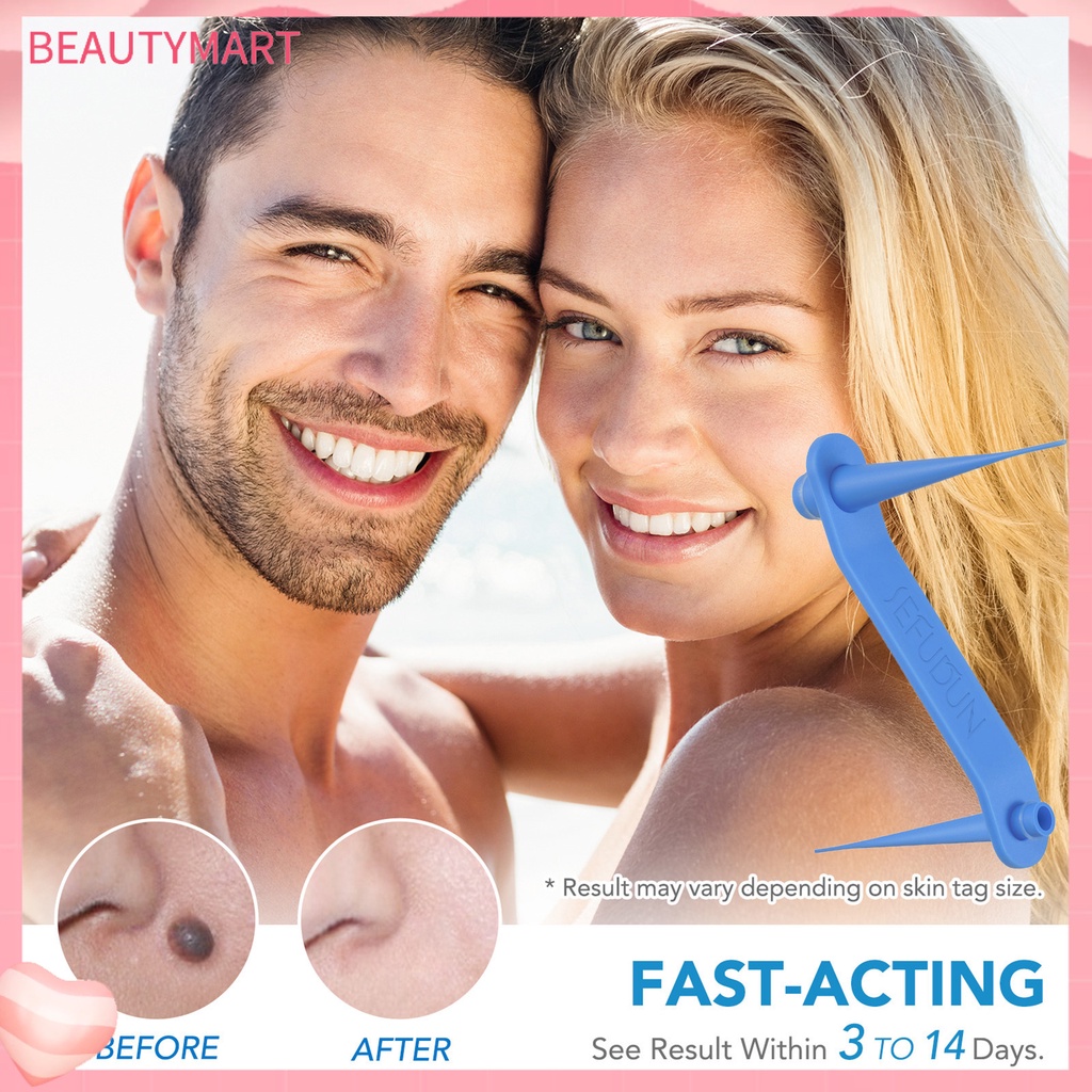 1 Bộ Dụng Cụ Loại Bỏ Mụn Cóc Trên Da Trọng Lượng Nhẹ Nhanh Chóng