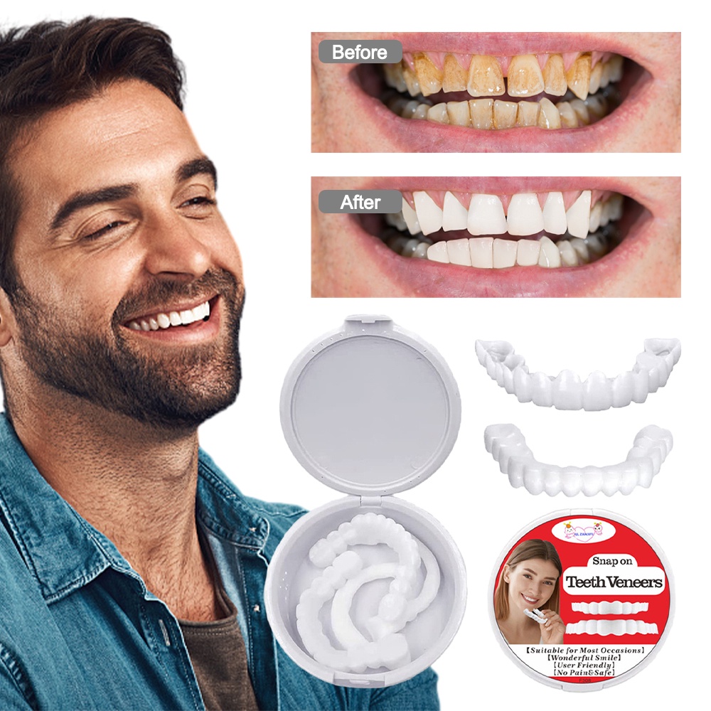 Gigi palsu veneer Giả Ngậm Nướu Bằng Silicon Làm Trắng Răng