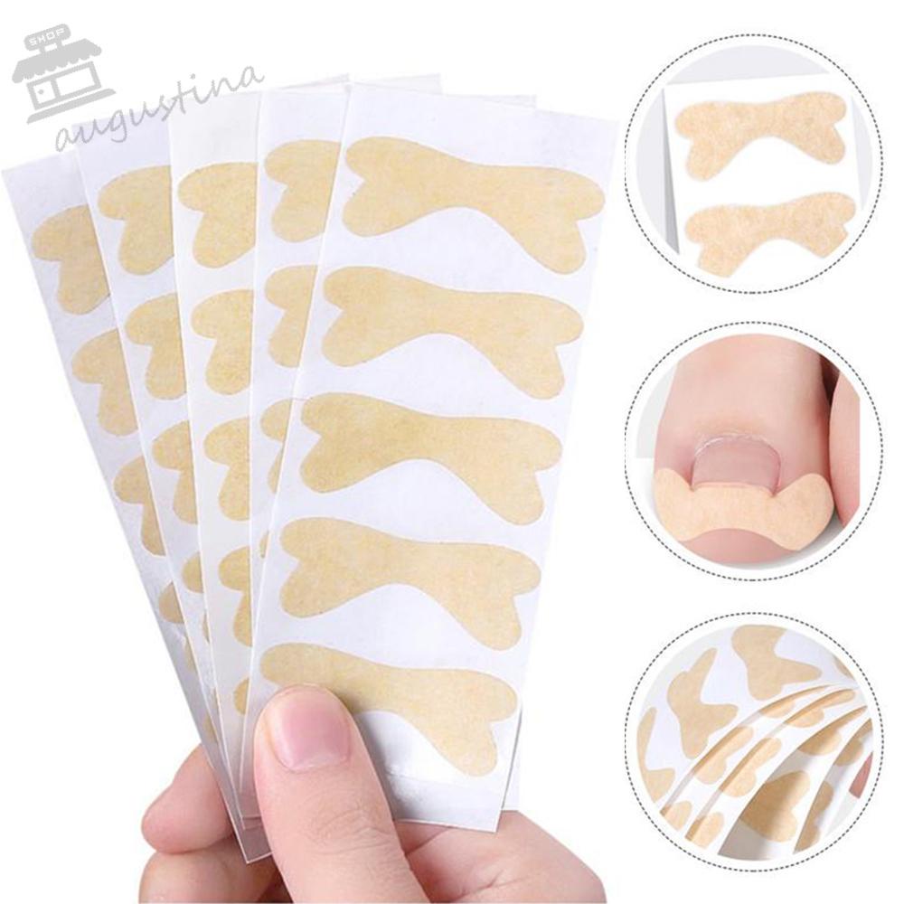 Set 25 Miếng Dán Điều Chỉnh Móng Chân AUGUSTINA Ingrown