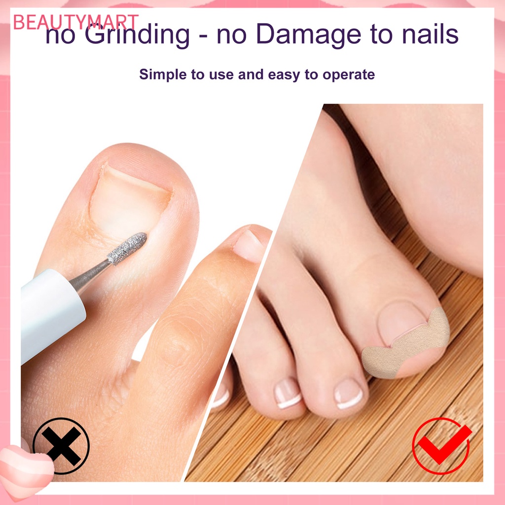 Set 50 Miếng Dán Móng Chân Tự Dính Chống Nước Thoáng Khí Chỉnh Sửa Lỗ Chân