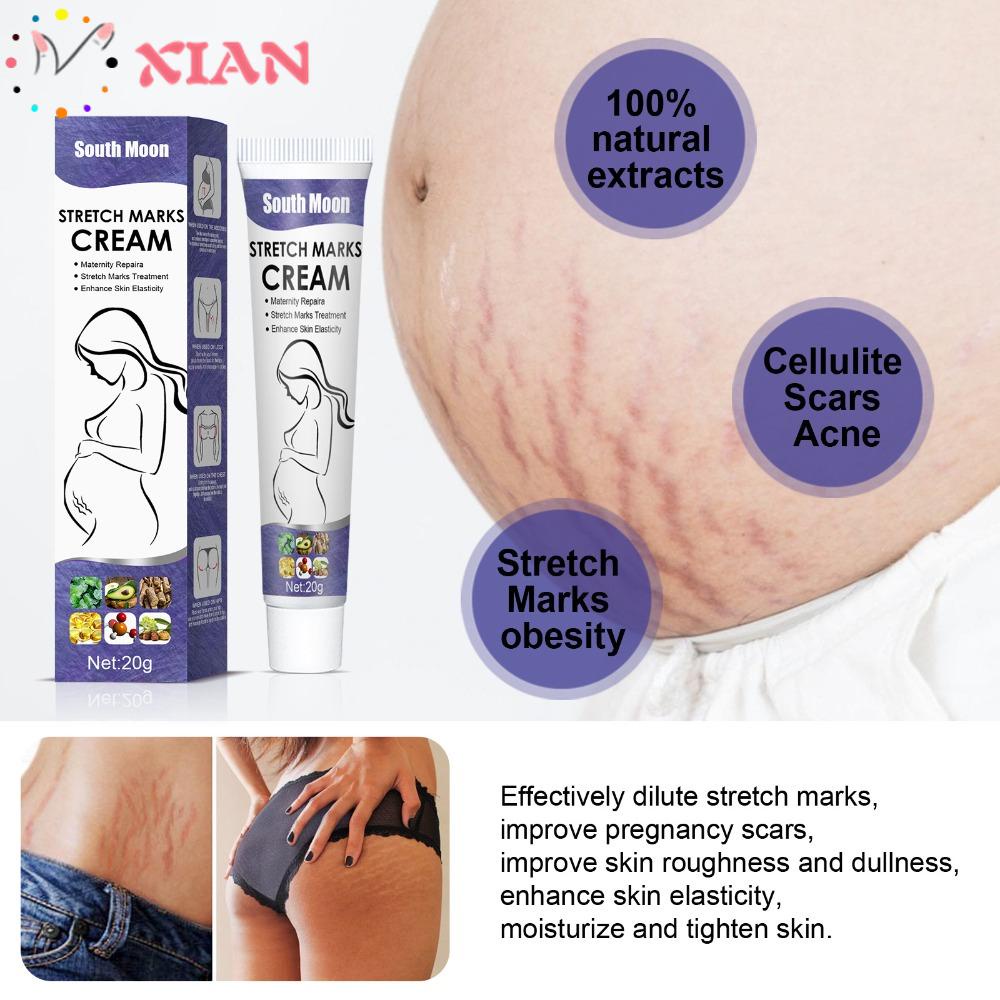 Xiantin Set 2 Kem Hỗ trợ giảm rạn da Cho Phụ Nữ Mang Thai