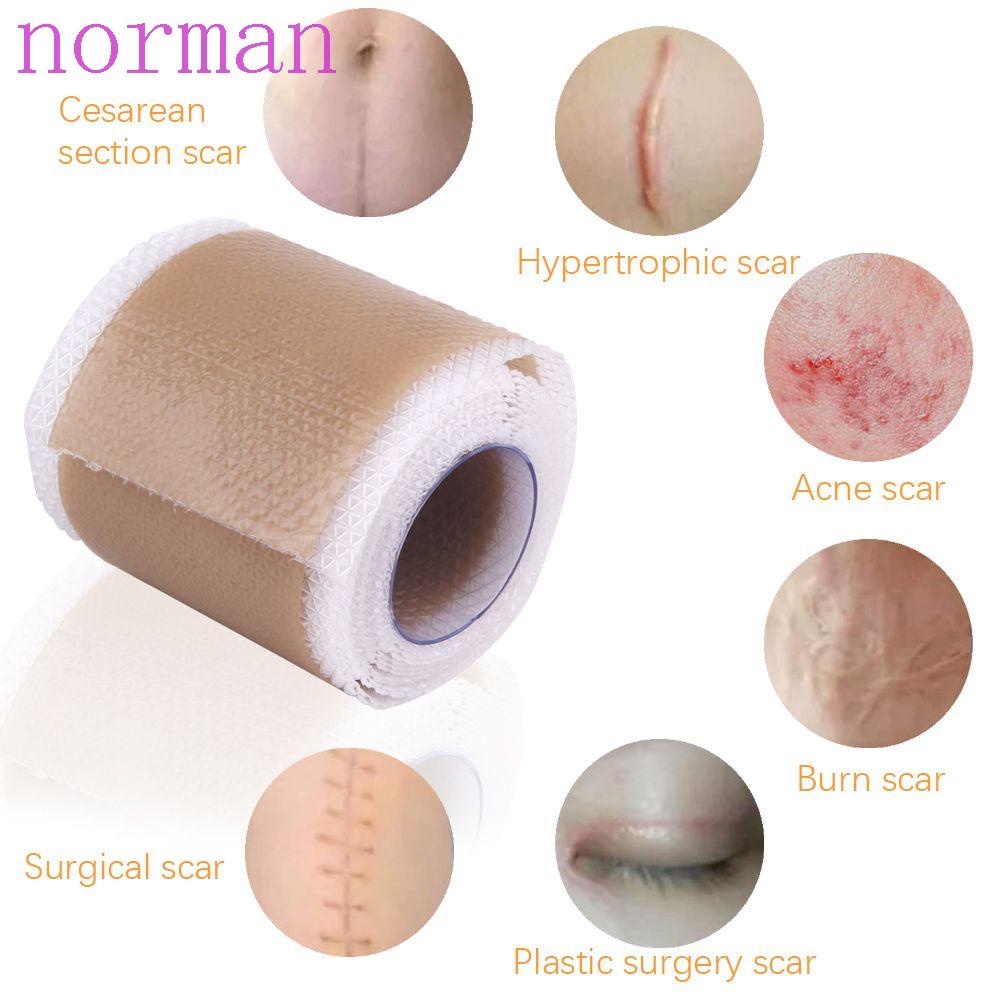 Băng Keo Hỗ Trợ Giảm Sẹo Mụn NORMAN Tự Dính Siêu Bền Dễ Sử Dụng