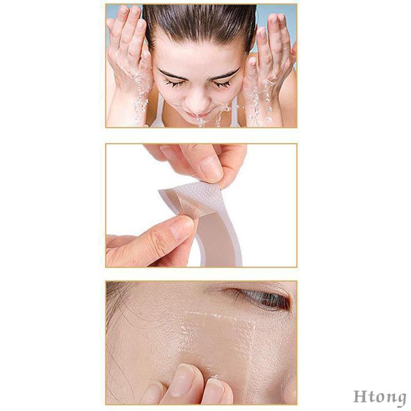 Cuộn Băng Keo Silicone Làm Mờ Sẹo
