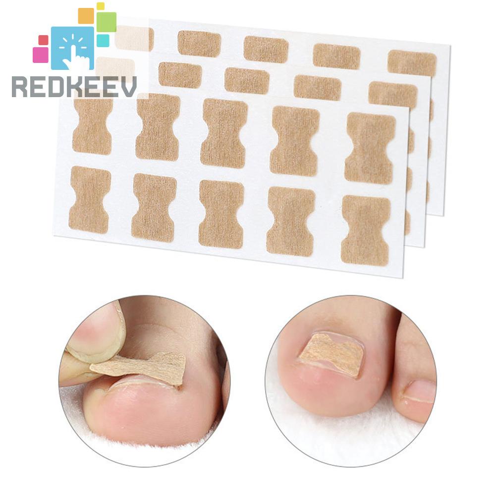 Set 10 Miếng Dán Chỉnh Sửa Móng Chân Tiện Dụng