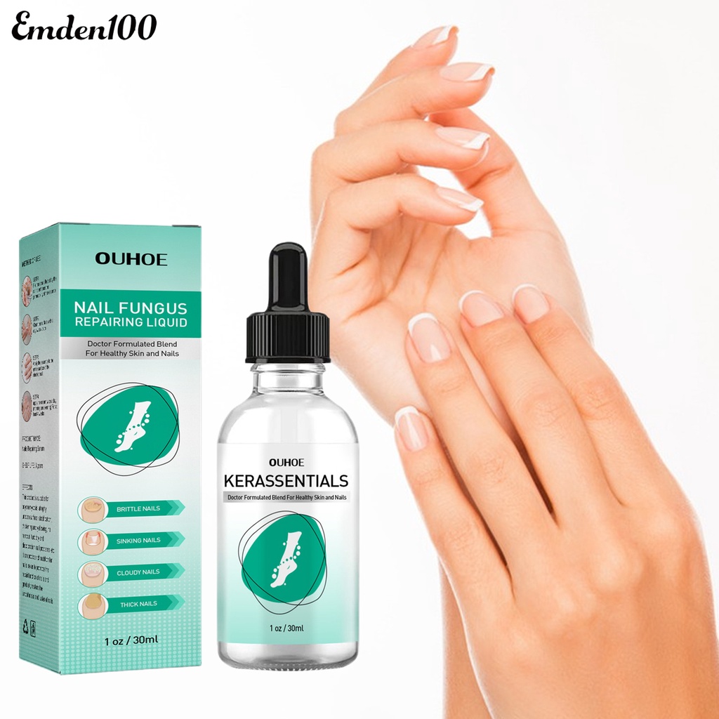 Tinh Chất Onychomycosis 30ml Hỗ Trợ Phục Hồi Móng Nhanh Chóng Và Hiệu Quả