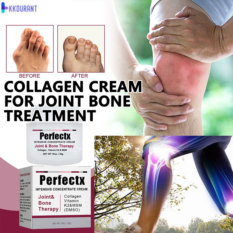 Perfectx Kem Trị Liệu Xương Khớp Điều Trị Bệnh Gút Khớp Đầu Gối Đau Ngón Chân Giảm Xương KKDURANT