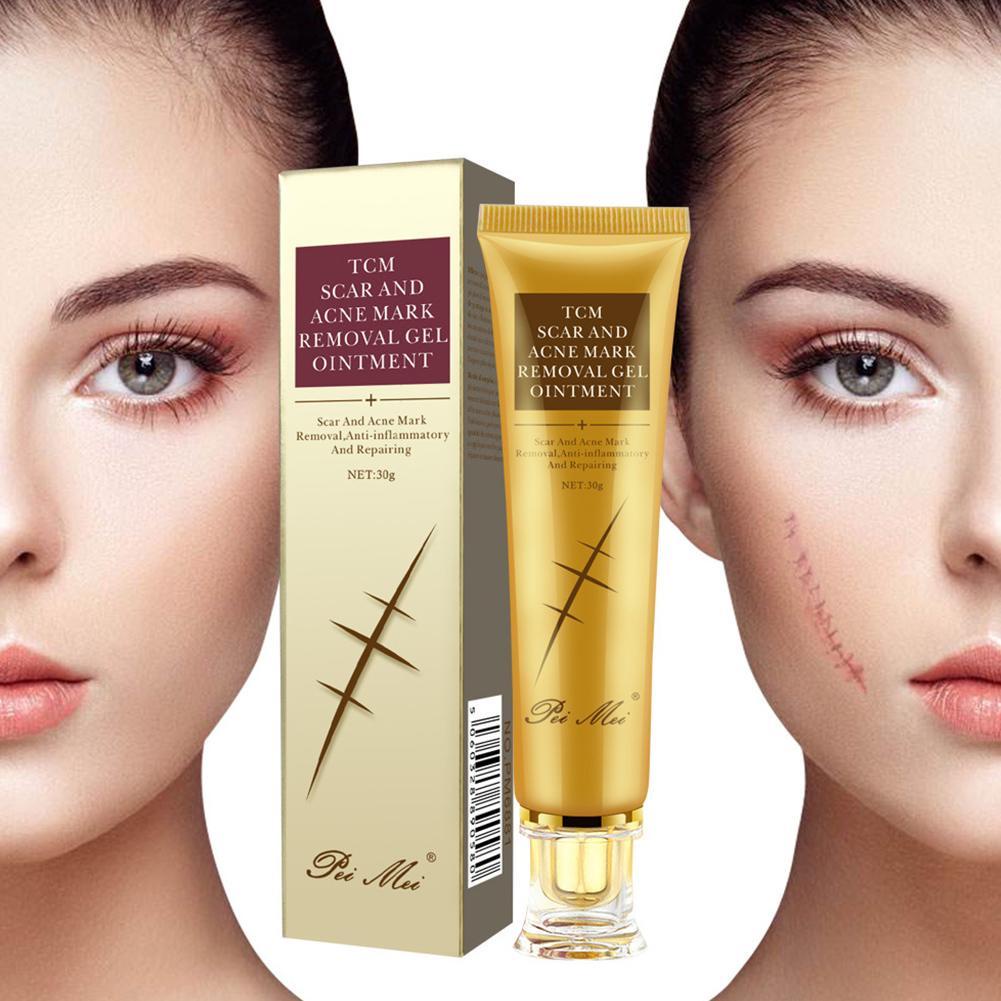 Gel Hỗ trợ giảm sẹo 30g Làm Mờ Vết Thâm M1O3