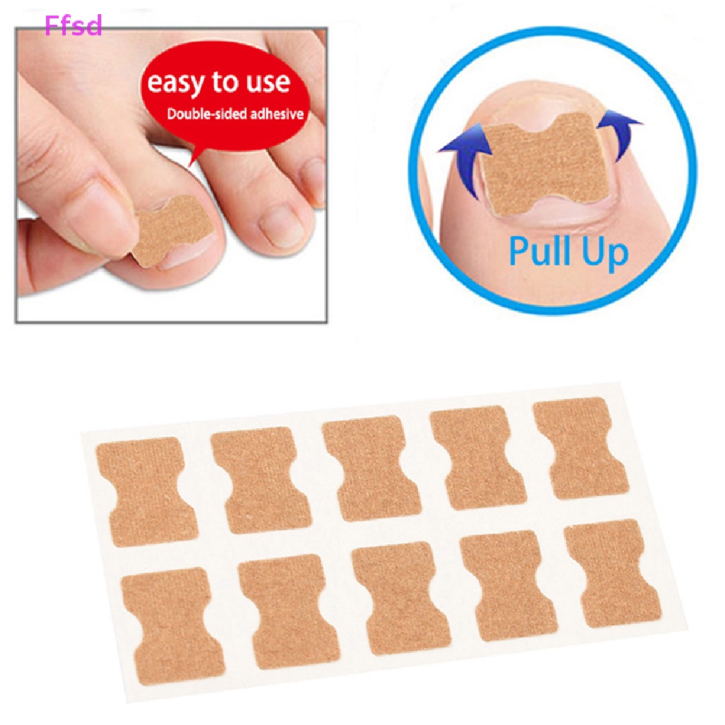 Set 50 Miếng Dán Chỉnh Sửa Móng Chân Mọc Ngược Tiện Dụng