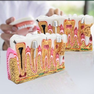Mô hình hàm răng giảng dạy mẫu hàm răng giảng dạy