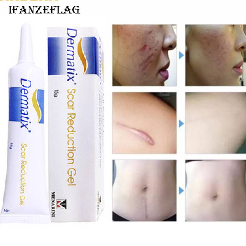 Kem sẹo MISS ROSE chất lượng cao