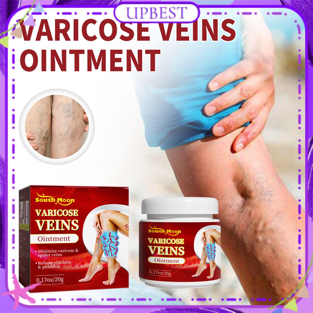 ♕ Thuốc mỡ trị giãn tĩnh mạch South Moon Giảm thiểu nhện giun đất Giảm đau chân sưng tấy Thúc đẩy tuần hoàn máu Kem chăm sóc cơ thể 20g UPBEST