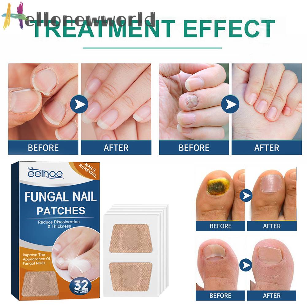 Bộ 32 Miếng Dán Điều Chỉnh Móng Tay Co Giãn Thoáng Khí Dễ Sử Dụng