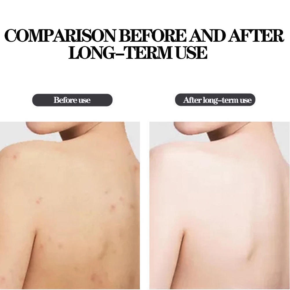 Khăn Tắm Chà Lưng Tẩy Tế Bào Chết Không Đau Unisex