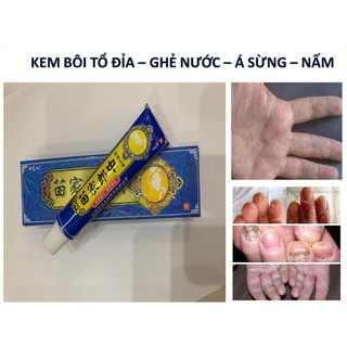 Kem bôi đông y thảo dược nấm ngứa 15g xanh dương