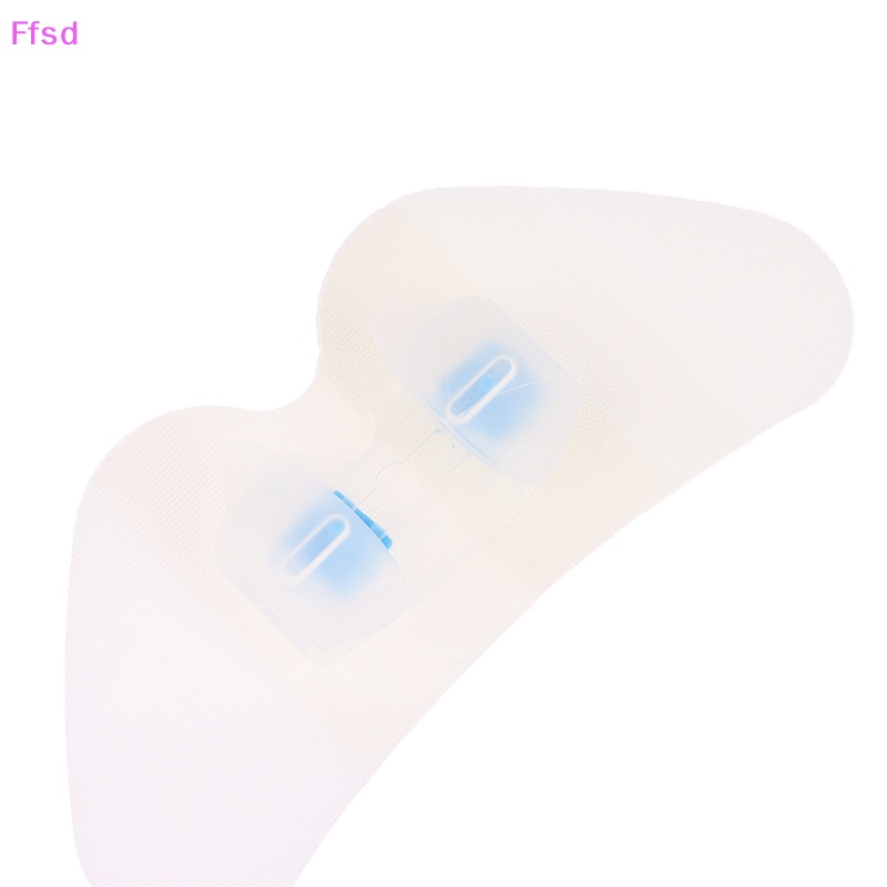 {Ffsd} Giá Đỡ Miếng Dán Cống Thoát Nước Che Khuyết Điểm Khí Gatrostomy * Bán Chạy