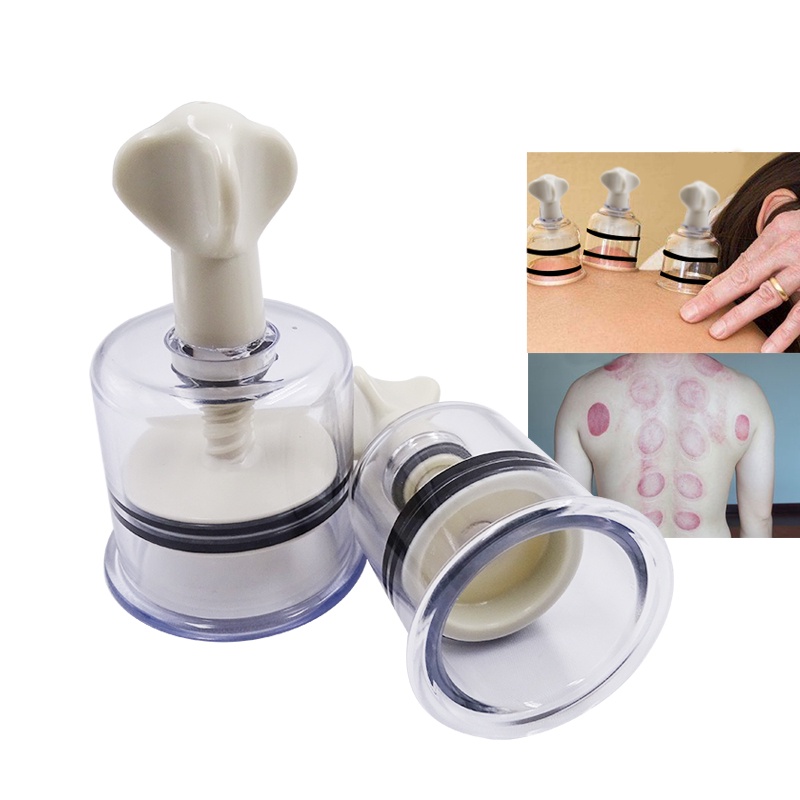 1 Cốc Hút Chân Không Massage Cơ Thể Truyền Thống Trung Quốc