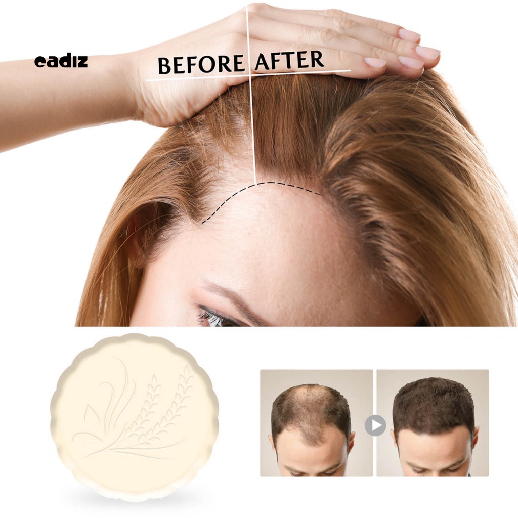 Xà Phòng Gội Đầu Chống Rụng Tóc Nhanh Chóng Không Gây Kích Ứng Cho Người Lớn