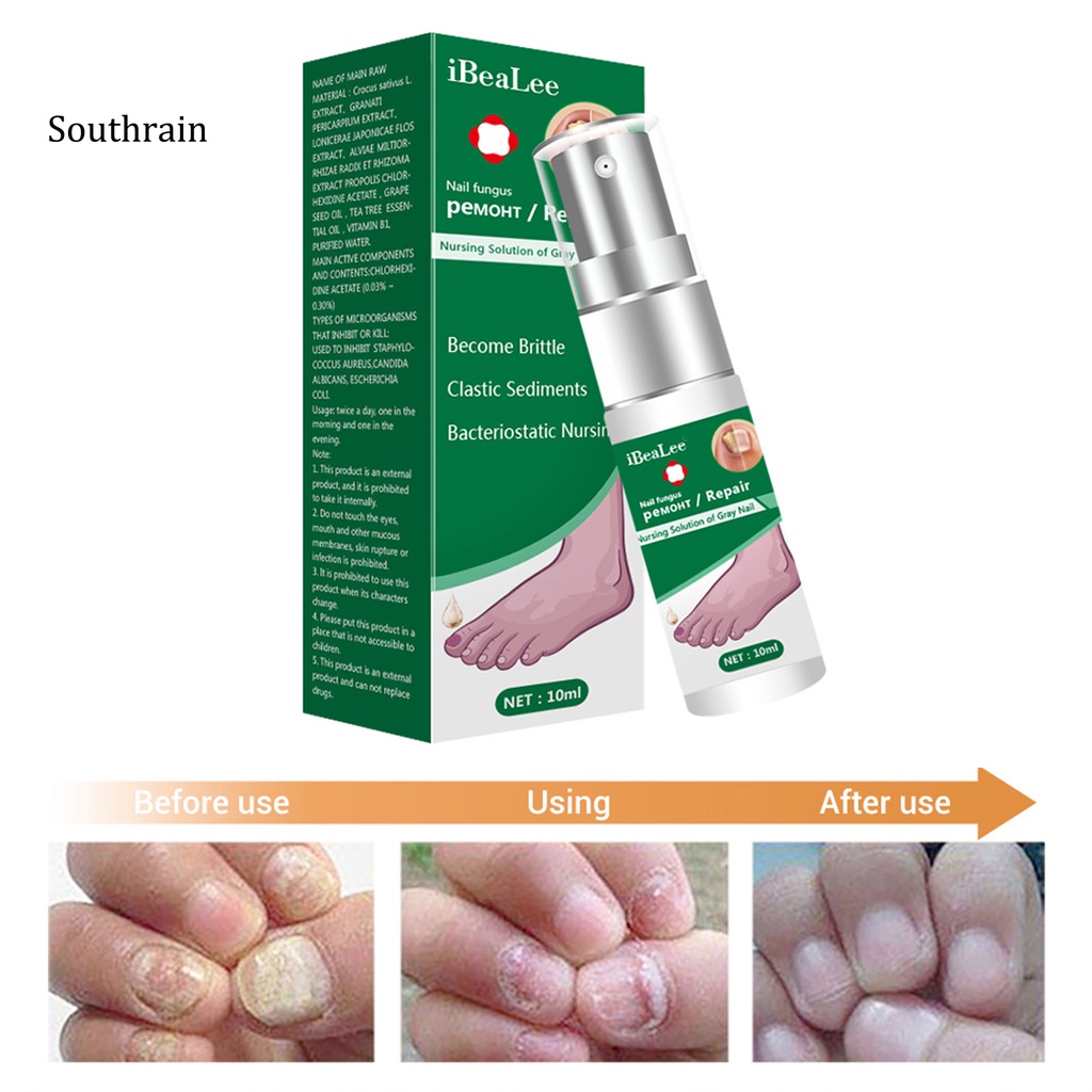 Dung Dịch Kháng Khuẩn 10ml Dễ Sử Dụng Cho Chăm Sóc Móng Tại Nhà