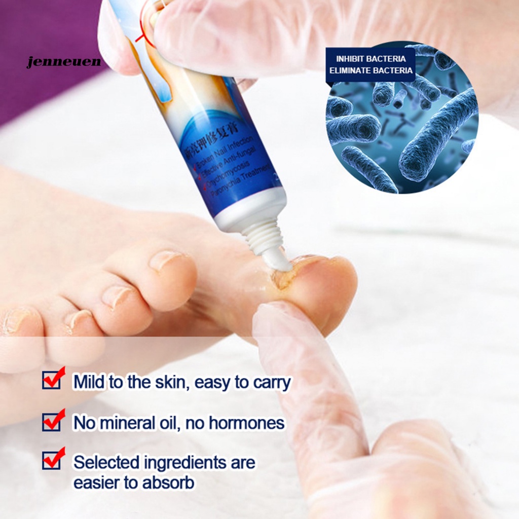 Kem Hỗ trợ giảm nấm Móng Chân 20g Tiện Dụng Chất Lượng Cao