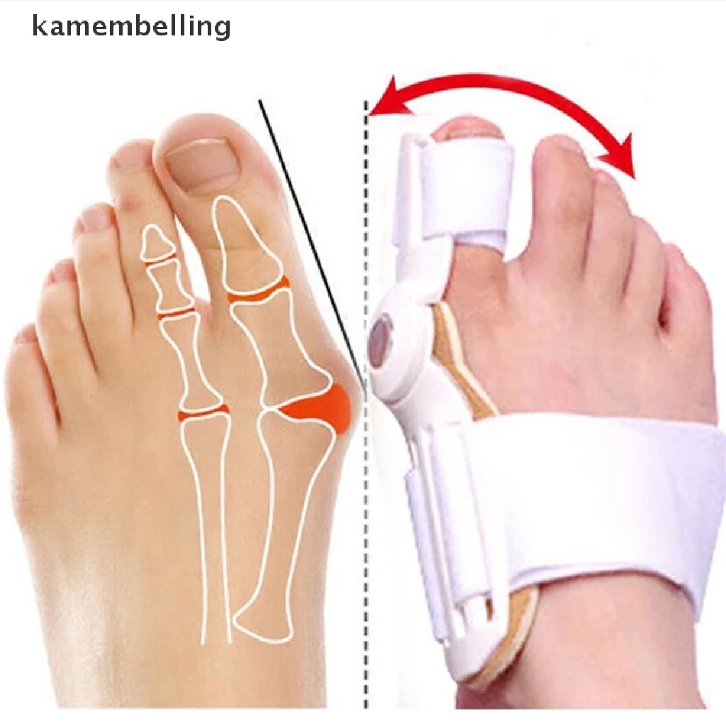 Nẹp Nẹp Điều Chỉnh Ngón Chân Cái Giảm Đau Hiệu Quả kamembelling