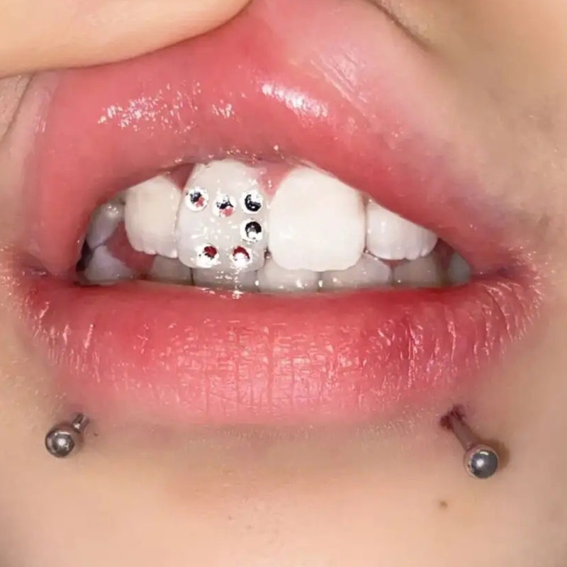 Răng Giả Kim Cương Lấp Lánh Có Thể Tháo Rời Trang Sức Chuyên Nghiệp