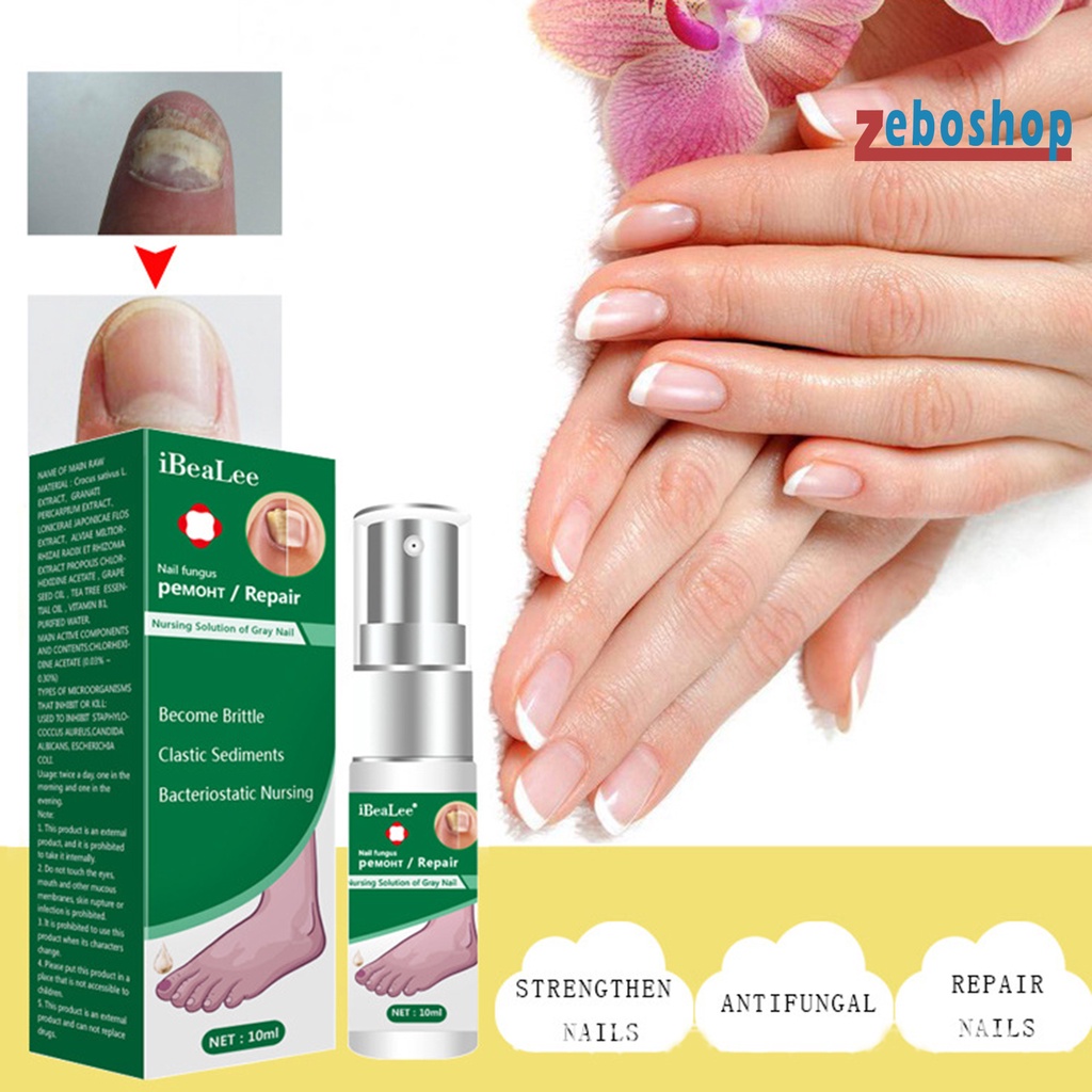 Dung Dịch Kháng Khuẩn 10ml Dễ Sử Dụng Cho Chăm Sóc Móng Tại Nhà