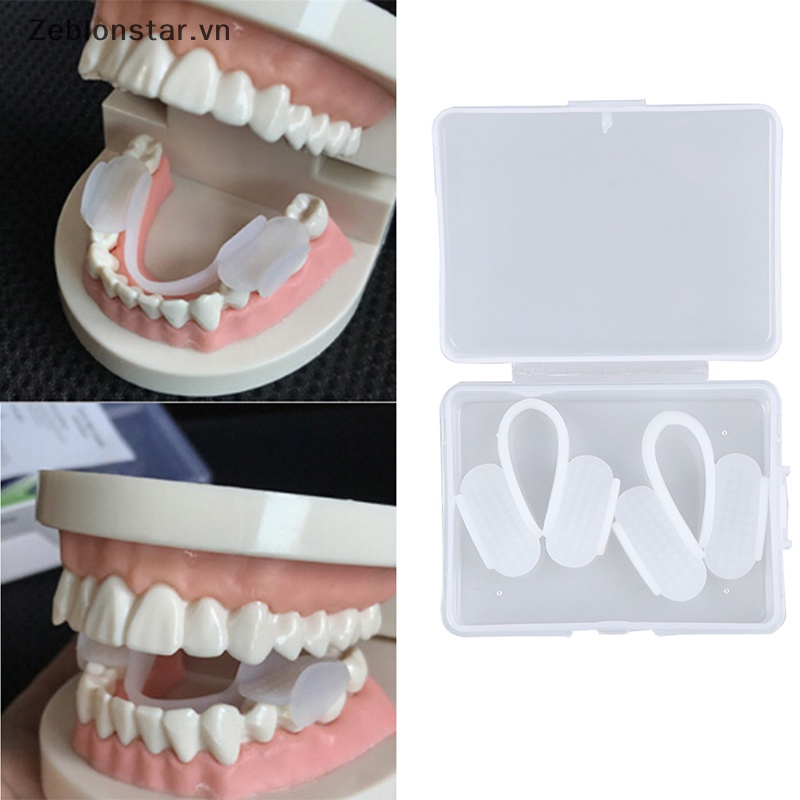 Bộ 2 Dụng Cụ Nẹp Bảo Vệ Răng Khi Ngủ Tiện Lợi