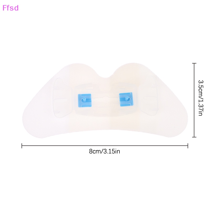 {Ffsd} Giá Đỡ Miếng Dán Cống Thoát Nước Che Khuyết Điểm Khí Gatrostomy * Bán Chạy